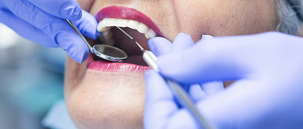 Best Broken or Chipped Tooth Repair in Gibsonia, PA